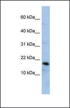 Anti-LCN1 antibody produced in rabbit affinity isolated antibody, lyophilized powder