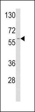 ANTI-TPA (CENTER) antibody produced in rabbit purified immunoglobulin, buffered aqueous solution