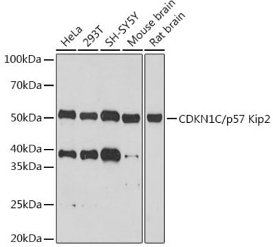 Anti-CDKN1C/p57 Kip2 Antibody, clone 6T4E6, Rabbit Monoclonal