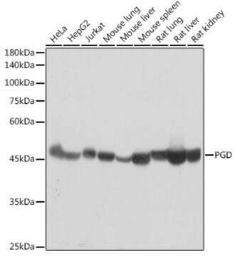 Przeciwciało anty-PGD, klon 9A2M7, królicze monoklonalne