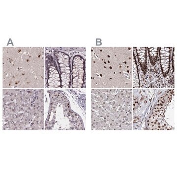 Anti-U2SURP antibody produced in rabbit Prestige Antibodies&#174; Powered by Atlas Antibodies, affinity isolated antibody