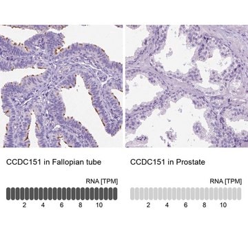 Anti-CCDC151 antibody produced in rabbit Prestige Antibodies&#174; Powered by Atlas Antibodies, affinity isolated antibody, buffered aqueous glycerol solution