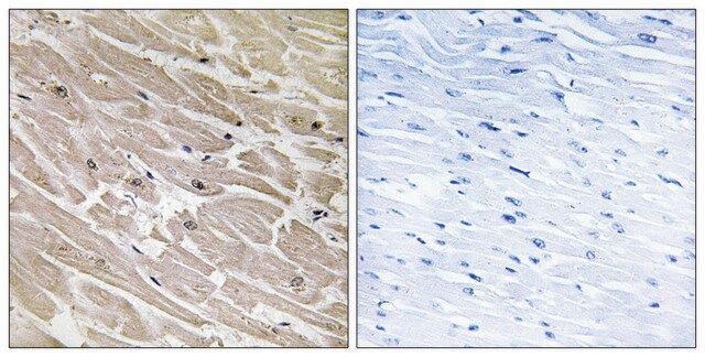 Anti-MRPL46 antibody produced in rabbit affinity isolated antibody