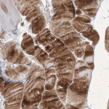 Anti-COX15 antibody produced in rabbit Prestige Antibodies&#174; Powered by Atlas Antibodies, affinity isolated antibody, buffered aqueous glycerol solution