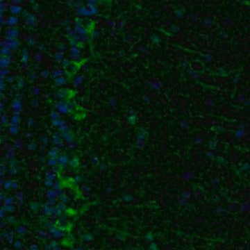 Anti-ECH1 antibody produced in rabbit Prestige Antibodies&#174; Powered by Atlas Antibodies, affinity isolated antibody, buffered aqueous glycerol solution