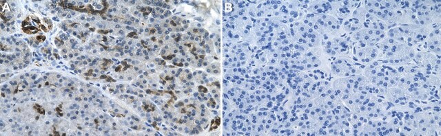 Anti-erbB4/HER4 Antibody, clone 1B7 ZooMAb&#174; Rabbit Monoclonal recombinant, expressed in HEK 293 cells