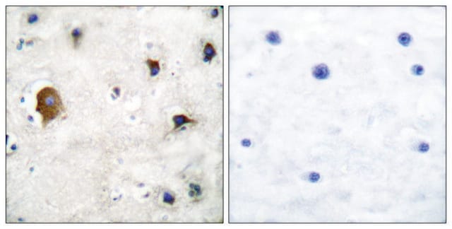 Anti-Connexin 43 antibody produced in rabbit affinity isolated antibody