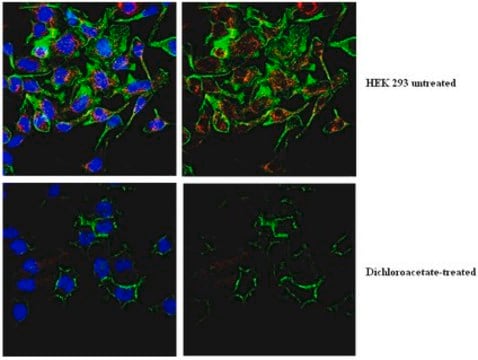 Anti-phospho PDHE1-A type I (Ser300) Antibody from rabbit, purified by affinity chromatography