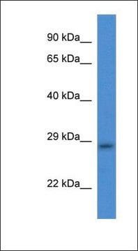 Anti-TMEM33 antibody produced in rabbit affinity isolated antibody