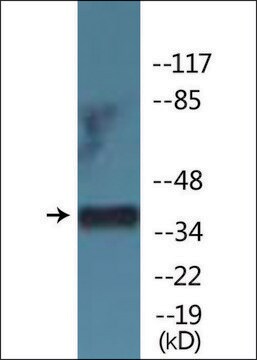 Anti-phospho-CDK7 (pThr170) antibody produced in rabbit affinity isolated antibody