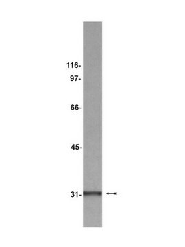 Anti-gC1qR Antibody, clone 74.5.2 ascites fluid, clone 74.5.2, Upstate&#174;