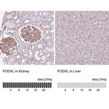 Anti-PODXL antibody produced in rabbit Prestige Antibodies&#174; Powered by Atlas Antibodies, affinity isolated antibody, buffered aqueous glycerol solution