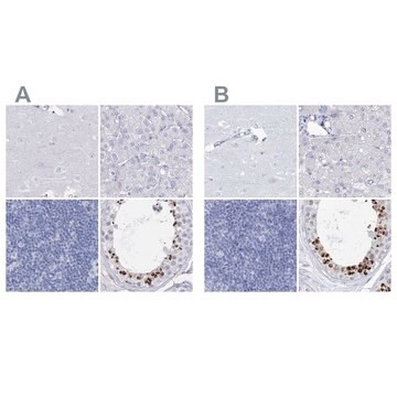 Anti-ACRV1 antibody produced in rabbit Prestige Antibodies&#174; Powered by Atlas Antibodies, affinity isolated antibody, buffered aqueous glycerol solution