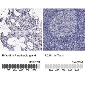 Anti-RCAN1 antibody produced in rabbit Prestige Antibodies&#174; Powered by Atlas Antibodies, affinity isolated antibody, buffered aqueous glycerol solution