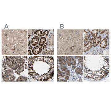 Anti-CYB5R1 antibody produced in rabbit Ab1, Prestige Antibodies&#174; Powered by Atlas Antibodies, affinity isolated antibody, buffered aqueous glycerol solution