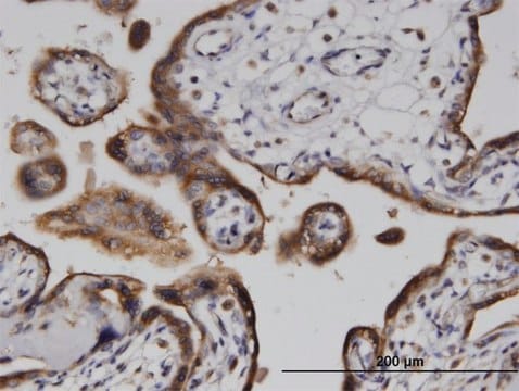 Monoclonal Anti-ADPRH antibody produced in mouse clone 1F11, purified immunoglobulin, buffered aqueous solution