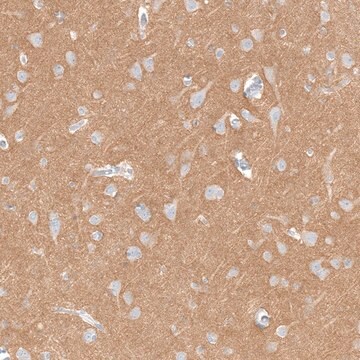 Anti-IGSF21 antibody produced in rabbit Prestige Antibodies&#174; Powered by Atlas Antibodies, affinity isolated antibody, buffered aqueous glycerol solution