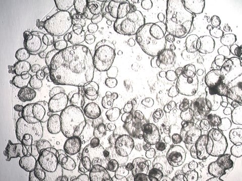 3dGRO Colon Intestinal Organoids, Age 51 (Prep ht-104-C)