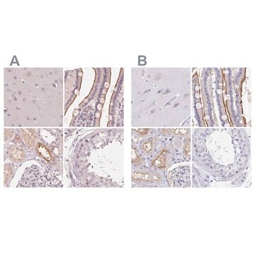 Anti-TREH antibody produced in rabbit Prestige Antibodies&#174; Powered by Atlas Antibodies, affinity isolated antibody, buffered aqueous glycerol solution