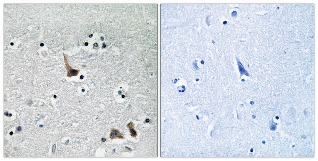 Anti-ATP6V1H antibody produced in rabbit affinity isolated antibody