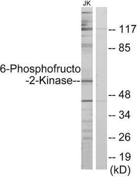 Anti-6-Phosphofructo-2-Kinase, N-Terminal antibody produced in rabbit affinity isolated antibody