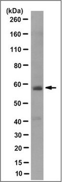 Anti-Paired box protein Pax-1 Antibody, clone 7F11.2 clone 7F11.2, from mouse