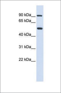 Anti-LOXL1 antibody produced in rabbit affinity isolated antibody