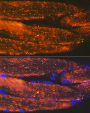 Anti-ACTN3 Antibody, clone 4H7E6, Rabbit Monoclonal