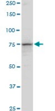 Anti-PCCA antibody produced in mouse purified immunoglobulin, buffered aqueous solution