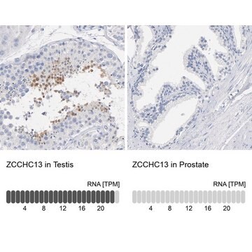 Anti-ZCCHC13 antibody produced in rabbit Prestige Antibodies&#174; Powered by Atlas Antibodies, affinity isolated antibody, buffered aqueous glycerol solution