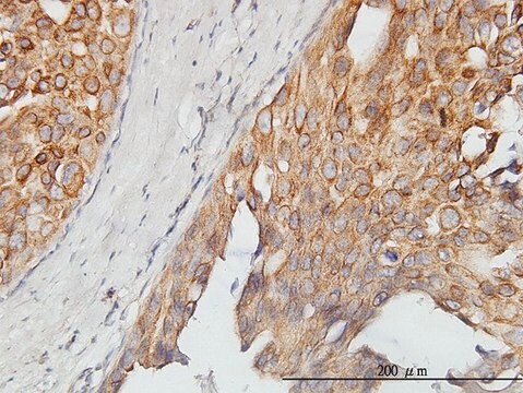 Monoclonal Anti-ASPSCR1 antibody produced in mouse clone 3D10-1D11, purified immunoglobulin, buffered aqueous solution