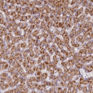 Anti-TYW1B antibody produced in rabbit Prestige Antibodies&#174; Powered by Atlas Antibodies, affinity isolated antibody, buffered aqueous glycerol solution