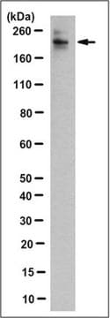 Anti-Histone Demethylase JARID1C Antibody, clone 2B4.2 clone 2B4.2, from mouse