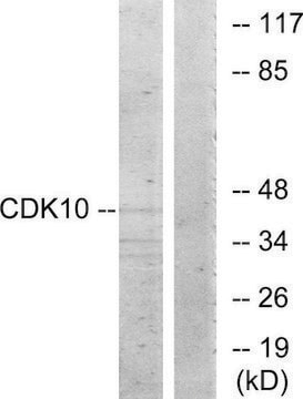 Anti-CDK10 antibody produced in rabbit affinity isolated antibody