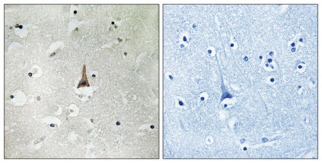 Anti-LRP10 antibody produced in rabbit affinity isolated antibody