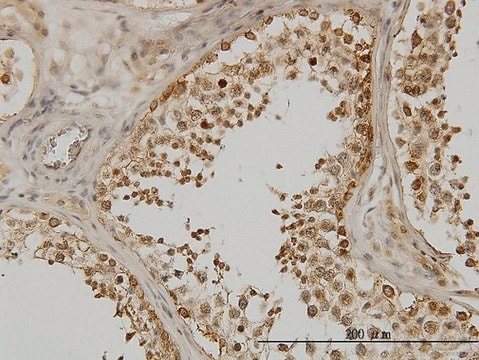 抗 DDX3Y 单克隆抗体 小鼠抗 clone 2D7, purified immunoglobulin, buffered aqueous solution