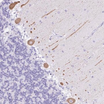 Anti-SEL1L2 antibody produced in rabbit Prestige Antibodies&#174; Powered by Atlas Antibodies, affinity isolated antibody, buffered aqueous glycerol solution