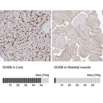 Anti-GUSB antibody produced in rabbit Prestige Antibodies&#174; Powered by Atlas Antibodies, affinity isolated antibody, buffered aqueous glycerol solution