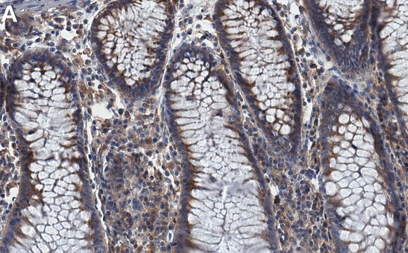 Anti-VPS35 Antibody, clone 1C7 ZooMAb&#174; Rabbit Monoclonal recombinant, expressed in HEK 293 cells