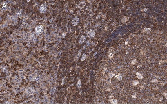 Anti-FNBP1 Antibody, clone 3C23 ZooMAb&#174; Rabbit Monoclonal recombinant, expressed in HEK 293 cells