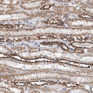 Anti-TMEM168 antibody produced in rabbit Prestige Antibodies&#174; Powered by Atlas Antibodies, affinity isolated antibody, buffered aqueous glycerol solution