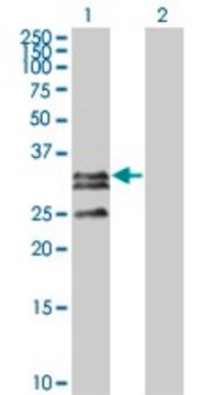 Monoclonal Anti-C1QTNF2 antibody produced in mouse clone 1D7-2C7, purified immunoglobulin, buffered aqueous solution