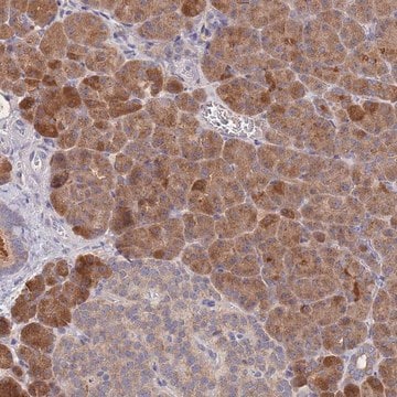 Anti-PPP6C antibody produced in rabbit Prestige Antibodies&#174; Powered by Atlas Antibodies, affinity isolated antibody, buffered aqueous glycerol solution