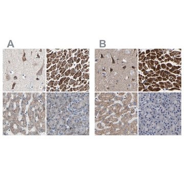 Anti-UQCRC2 antibody produced in rabbit Prestige Antibodies&#174; Powered by Atlas Antibodies, affinity isolated antibody, buffered aqueous glycerol solution