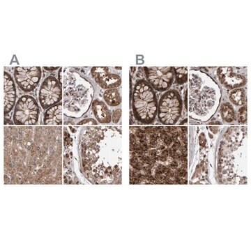 Anti-PECR antibody produced in rabbit Prestige Antibodies&#174; Powered by Atlas Antibodies, affinity isolated antibody, buffered aqueous glycerol solution, Ab2