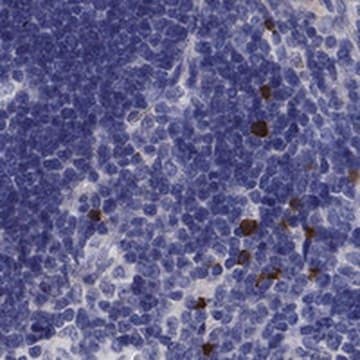 Anti-FRMD1 antibody produced in rabbit Prestige Antibodies&#174; Powered by Atlas Antibodies, affinity isolated antibody, buffered aqueous glycerol solution, ab2