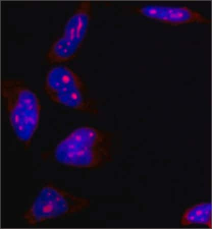 小鼠抗B23单克隆抗体clone FC82291, purified from hybridoma cell 