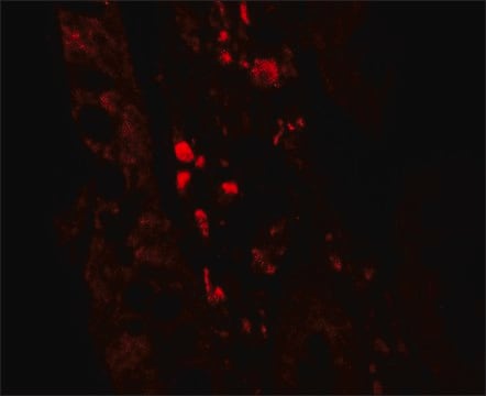 Anti-GLIPR1 antibody produced in rabbit affinity isolated antibody