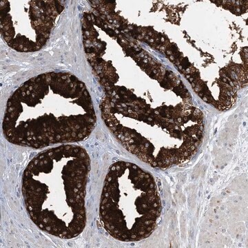 Anti-TRAPPC13 antibody produced in rabbit Prestige Antibodies&#174; Powered by Atlas Antibodies, affinity isolated antibody, buffered aqueous glycerol solution