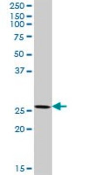 Anti-XRCC6BP1 antibody produced in rabbit purified immunoglobulin, buffered aqueous solution